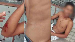 Imagem Vídeo: mãe denuncia agentes do Ronda no Bairro por agressão e injúria racial contra filho de 17 anos