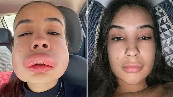 Foto: Reprodução/Glamour Brasil