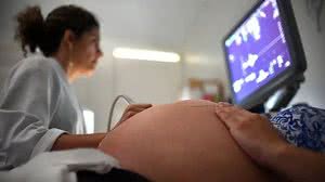 Foto: André Borges/Agência Brasília