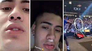 Imagem MC Kevinho é levado para o hospital após ser atingido no rosto por placa de PVC em show
