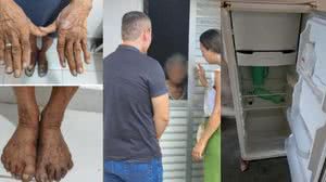 Condições de higiene em que a idosa foi encontrada eram precárias | Foto: Reprodução / Ascom Defensoria