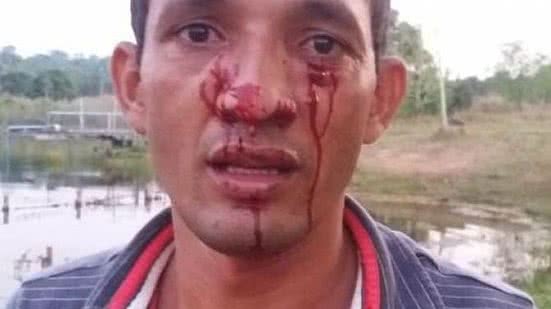 Imagem Empresário é atacado no rosto por sucuri de 3,5 metros durante pescaria