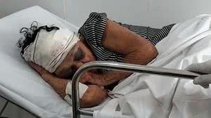 Idosa foi espancada por bandidos que invadiram sua residência | TV Mirante - Reprodução