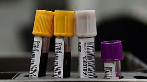 Foto: Agencia Brasil