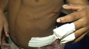 Menino foi socorrioo e está fora de perigo | Reprodução / TV Pajuçara