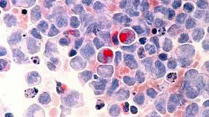 Opções de tratamento trazem benefícios de sobrevida aos pacientes | Foto: Divulgação/INCA