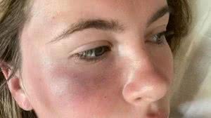 Imagem Filha de ator famoso é agredida por desconhecida: 'Estava fora de si'