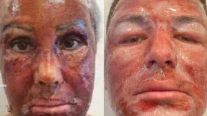 Imagem Após morte de paciente, Anvisa anuncia medida contra uso de fenol