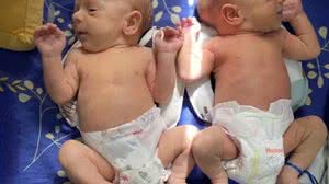 Lorenzo e Valentín são gêmeos iguaizinhos, garante a mãe | Foto: Reprodução/Twitter