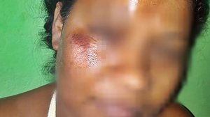 Reprodução/Alagoas Web