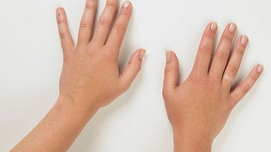 Mãos | Reprodução