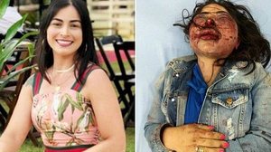 Jane Cherobin foi levada para um hospital, onde permanece internada. | BNews