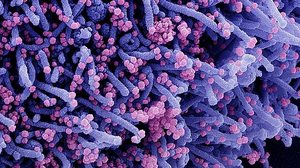 National Institute of Allergy and Infectious Diseases / Reprodução