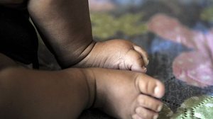 Maior problema é semelhança de sintomas com doenças comuns | Foto: Marcello Casal Jr. / Agência Brasil