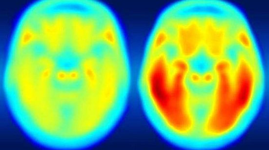 Foto: Matthew R. Brier