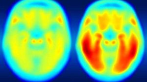 Foto: Matthew R. Brier