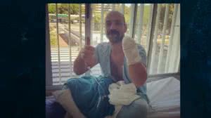 Imagem Vídeo: policial tem mão decepada por facão após tentar separar briga de casal