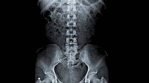 Reprodução Metro Jornal