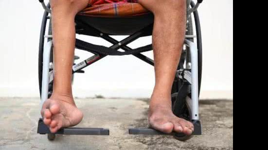 A poliomielite pode causar a paralisia definitiva, principalmente dos membros inferiores. | Foto: Reprodução / Biologia Net