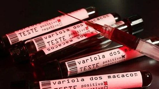 Imagem Sesau investiga 55 casos suspeitos de varíola dos macacos em Alagoas