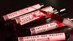 Imagem Sesau investiga 55 casos suspeitos de varíola dos macacos em Alagoas