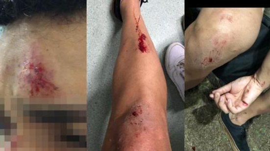 Após agressões, jovens precisaram de atendimento médico | Foto: Cortesia ao TNH1