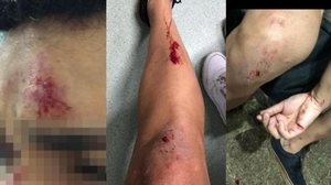Após agressões, jovens precisaram de atendimento médico | Foto: Cortesia ao TNH1