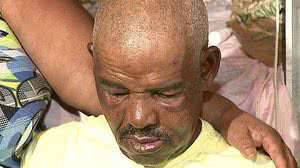 O idoso agredido | Reprodução/TV Jornal