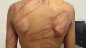 Imagem Homem espanca sobrinho ao descobrir que o jovem é gay