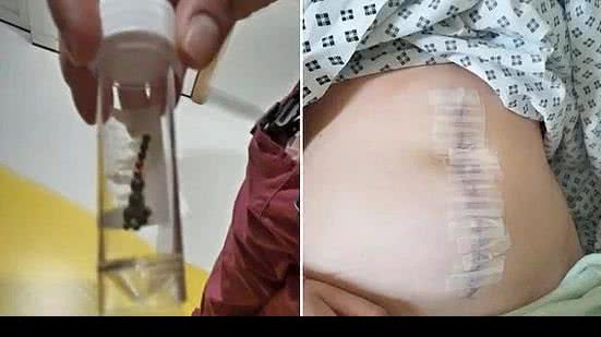 Reprodução / Liverpool Echo