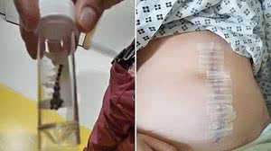 Reprodução / Liverpool Echo