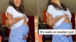 Imagem Jovem viraliza no TikTok ao mostrar cisto no ovário que parece gravidez; vídeo