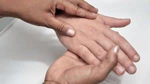 Imagem Orla da Ponta Verde vai receber ação de conscientização contra a hanseníase neste domingo