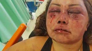 Imagem "Não consigo reconhecer minha irmã", diz irmão de mulher espancada