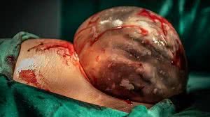 Foto: Reprodução/ Ludmila Gusman