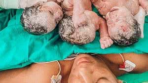 Foto: Divulgação/Hospital Marieta Konder Bornhausen