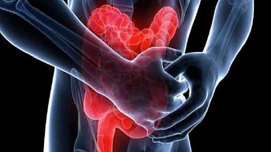 Alerta é da campanha Maio Roxo, da Sociedade de Coloproctologia | Foto: Reprodução