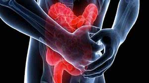 Alerta é da campanha Maio Roxo, da Sociedade de Coloproctologia | Foto: Reprodução