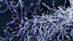 © National Institute of Allergy and Infectious Diseases / NIAID