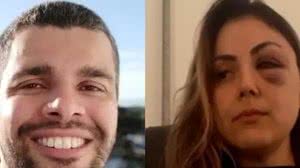 Procuradora e agressor trabalhavam juntos na Prefeitura de Peruíbe | Foto: Reprodução