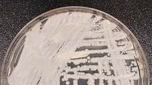 CDC / Dr. Leanor Hailey