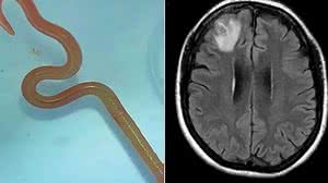 Foto: Reprodução/Camberra Health