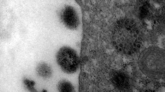 Foto: Reprodução/Fiocruz