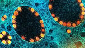 Foto: Instituto Nacional de Alergia e Doenças Infecciosas dos EUA