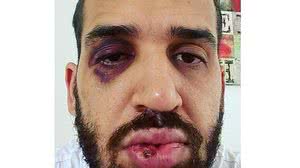 Imagem Médico é agredido por familiar após alertar sobre riscos da Covid-19, no Paraná