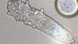 Imagem Ácaros minúsculos vivem e acasalam em nossos rostos; devemos nos preocupar?