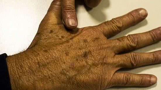 Foto: Reprodução/Agência Brasil