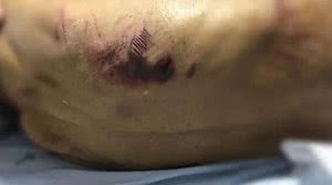 Foto: Reprodução/PC-GO