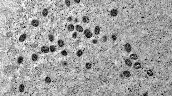 Foto: Reprodução/Fiocruz