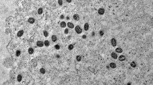 Débora F. Barreto-Vieira / IOC / Fiocruz